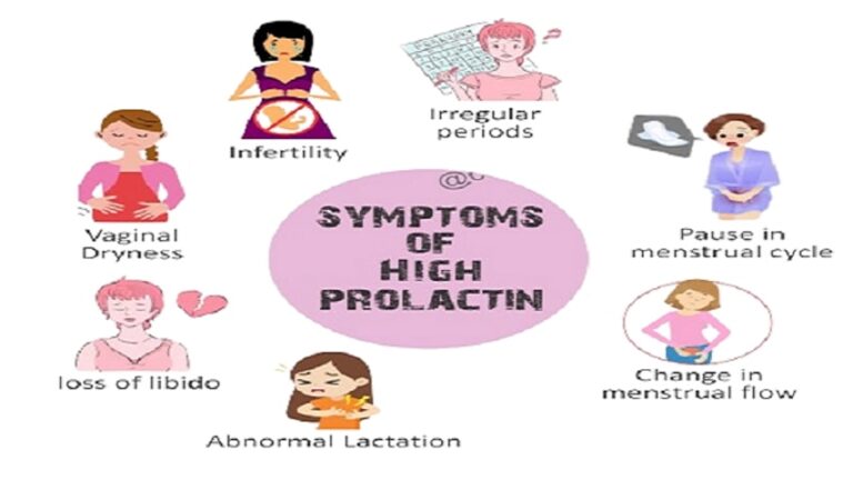 The Signs and Treatments of Hyperprolactinemia