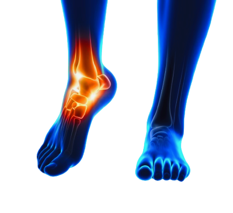Discover the Benefits of Prebel (Pregabalin) for Nerve Pain Management